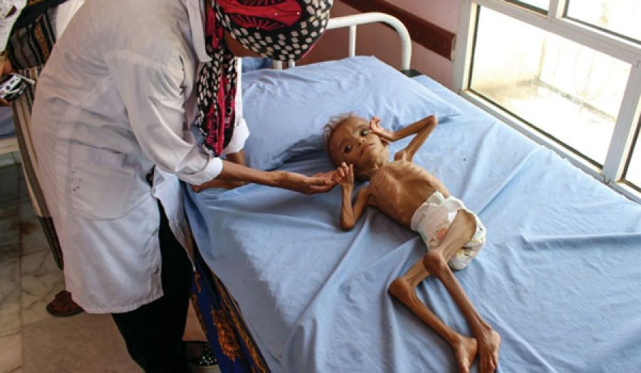 الأمم المتحدة لم تخسر الحرب على المجاعة في اليمن  بل هي التي أوجدتها وتؤجج سعارها