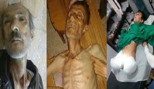 تقرير يكشف تآمر الأمم المتحدة على أهل مضايا تنفيذا للسياسة الأمريكية: "إما القتل بالأسلحة المدمّرة والجوع.. وإما الخضوع"